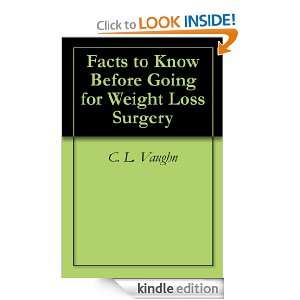 Facts to Know Before Going for Weight Loss Surgery C. L. Vaughn 