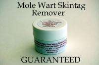 Warts, moles & Skin Tag remover,100 % GUARANTEED  